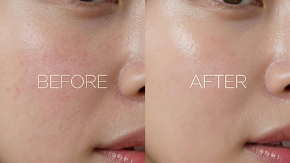 Nownoon Collagen Retinol Hyaluronic Acid Cream